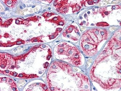 Cytokeratin 8 Antibody in Immunohistochemistry (Paraffin) (IHC (P))