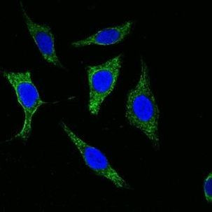 Cytokeratin Pan Antibody in Immunocytochemistry (ICC/IF)