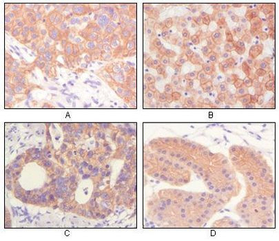 Cytokeratin Pan Antibody in Immunohistochemistry (Paraffin) (IHC (P))