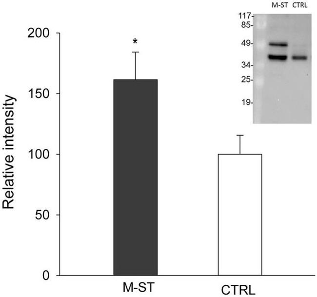 Cytokeratin 8 Antibody in Western Blot (WB)