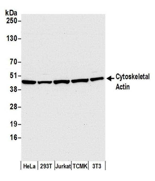Cytoskeletal Actin Antibody in Western Blot (WB)