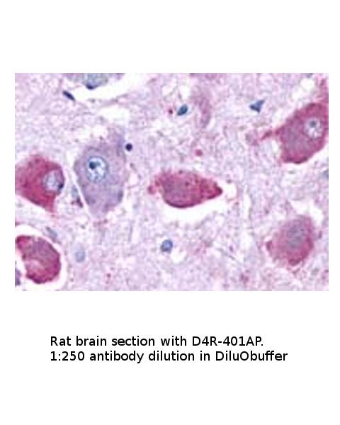 Dopamine Receptor D4 Antibody in Immunohistochemistry (IHC)