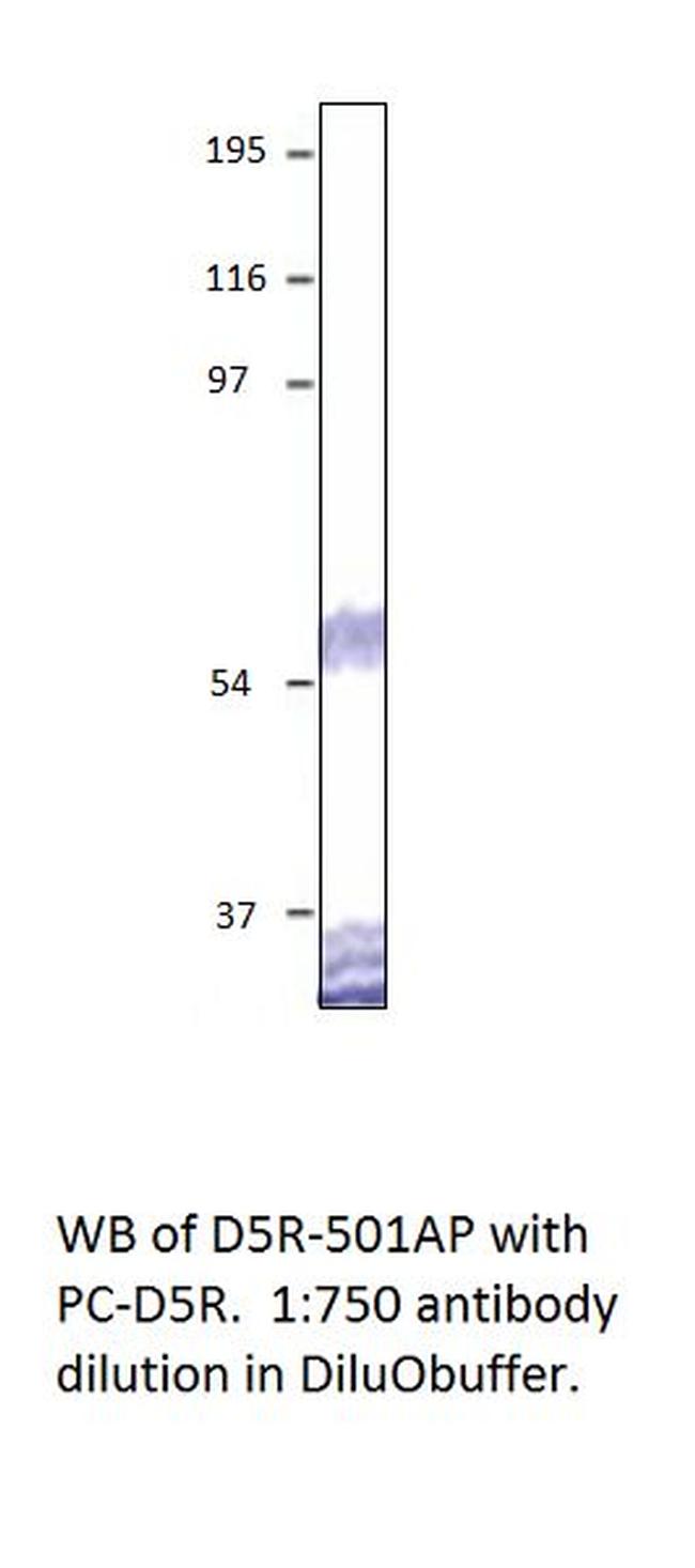 Dopamine D5 Receptor Antibody in Western Blot (WB)