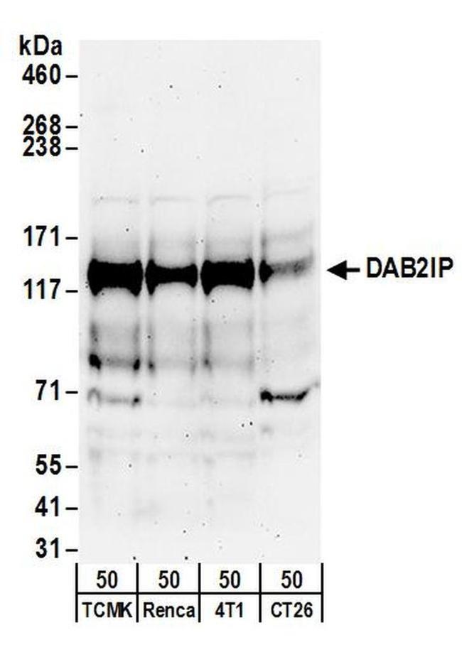 DAB2IP Antibody in Western Blot (WB)