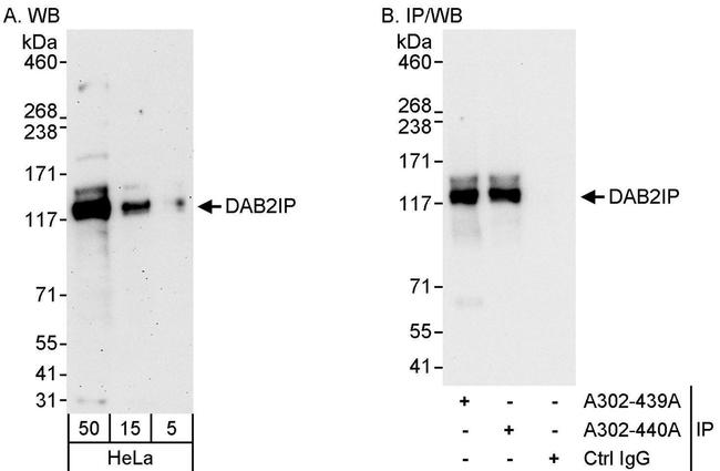 DAB2IP Antibody in Western Blot (WB)