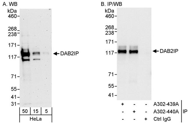 DAB2IP Antibody in Western Blot (WB)