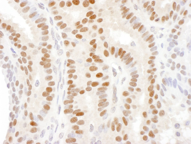 DACH1 Antibody in Immunohistochemistry (IHC)