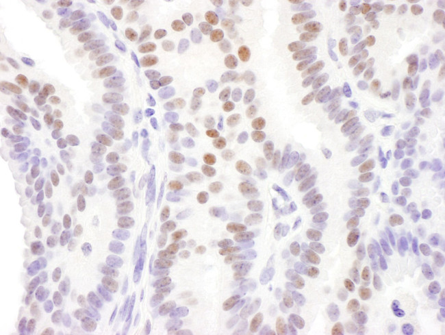 DACH1 Antibody in Immunohistochemistry (IHC)