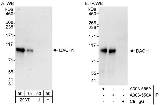 DACH1 Antibody in Western Blot (WB)