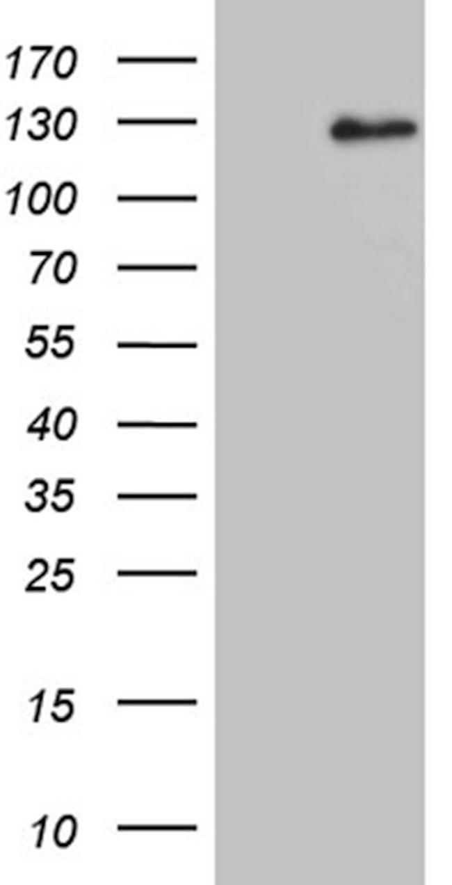 DACT1 Antibody in Western Blot (WB)