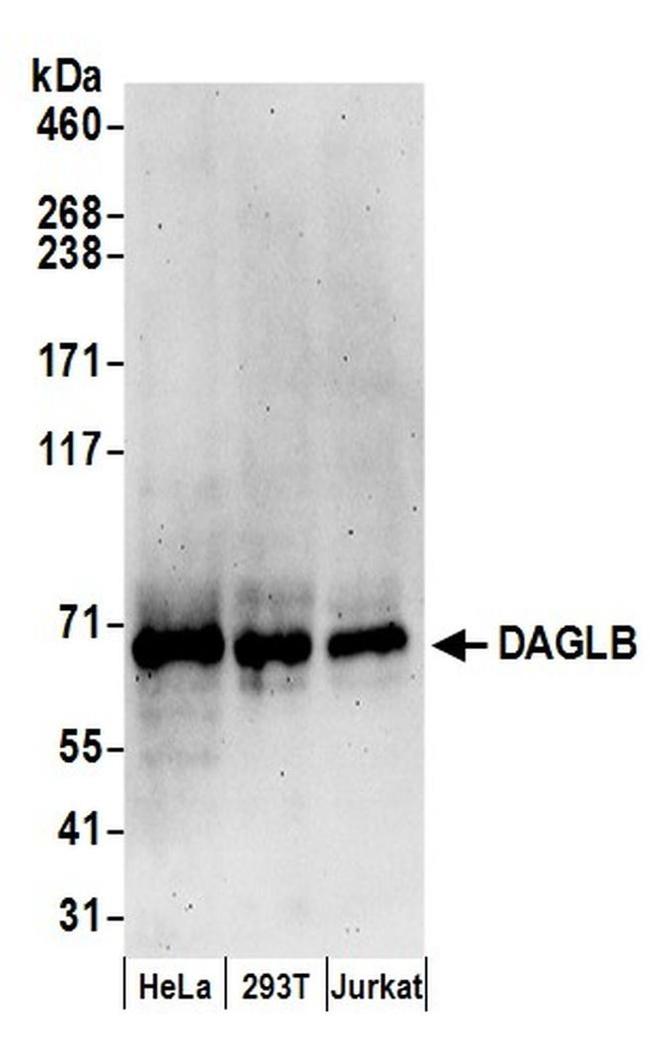 DAGLB Antibody in Western Blot (WB)