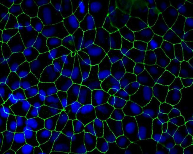 Mouse IgG (H+L) Highly Cross-Adsorbed Secondary Antibody in Immunocytochemistry (ICC/IF)