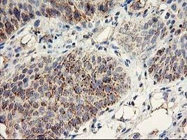 DAND5 Antibody in Immunohistochemistry (Paraffin) (IHC (P))