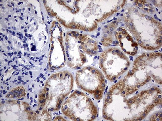 DAP3 Antibody in Immunohistochemistry (Paraffin) (IHC (P))