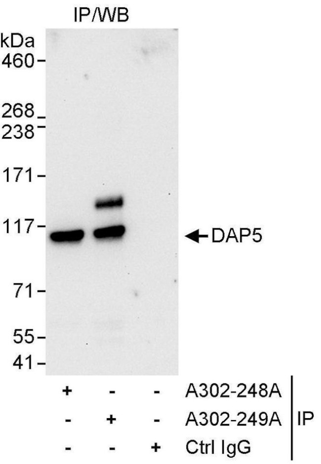 DAP5 Antibody in Immunoprecipitation (IP)