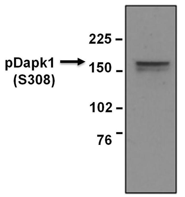 Phospho-DAPK1 (Ser308) Antibody in Western Blot (WB)