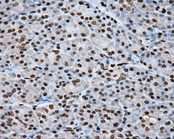 DAPK2 Antibody in Immunohistochemistry (Paraffin) (IHC (P))