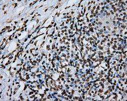 DAPK2 Antibody in Immunohistochemistry (Paraffin) (IHC (P))