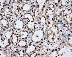 DAPK2 Antibody in Immunohistochemistry (Paraffin) (IHC (P))