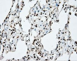 DAPK2 Antibody in Immunohistochemistry (Paraffin) (IHC (P))