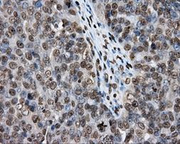 DAPK2 Antibody in Immunohistochemistry (Paraffin) (IHC (P))