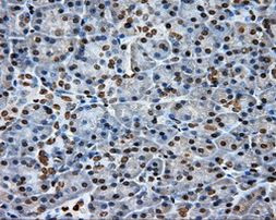 DAPK2 Antibody in Immunohistochemistry (Paraffin) (IHC (P))