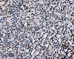 DAPK2 Antibody in Immunohistochemistry (Paraffin) (IHC (P))