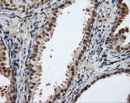 DAPK2 Antibody in Immunohistochemistry (Paraffin) (IHC (P))