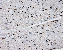 DAPK2 Antibody in Immunohistochemistry (Paraffin) (IHC (P))