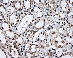 DAPK2 Antibody in Immunohistochemistry (Paraffin) (IHC (P))