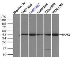 DAPK2 Antibody in Immunoprecipitation (IP)