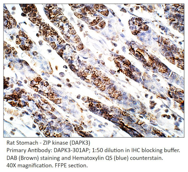 ZIP Kinase Antibody in Immunohistochemistry (IHC)