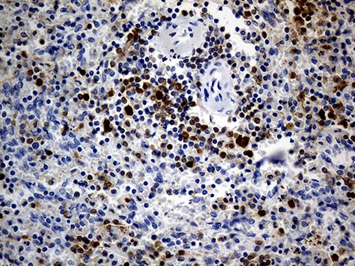 DAPP1 Antibody in Immunohistochemistry (Paraffin) (IHC (P))