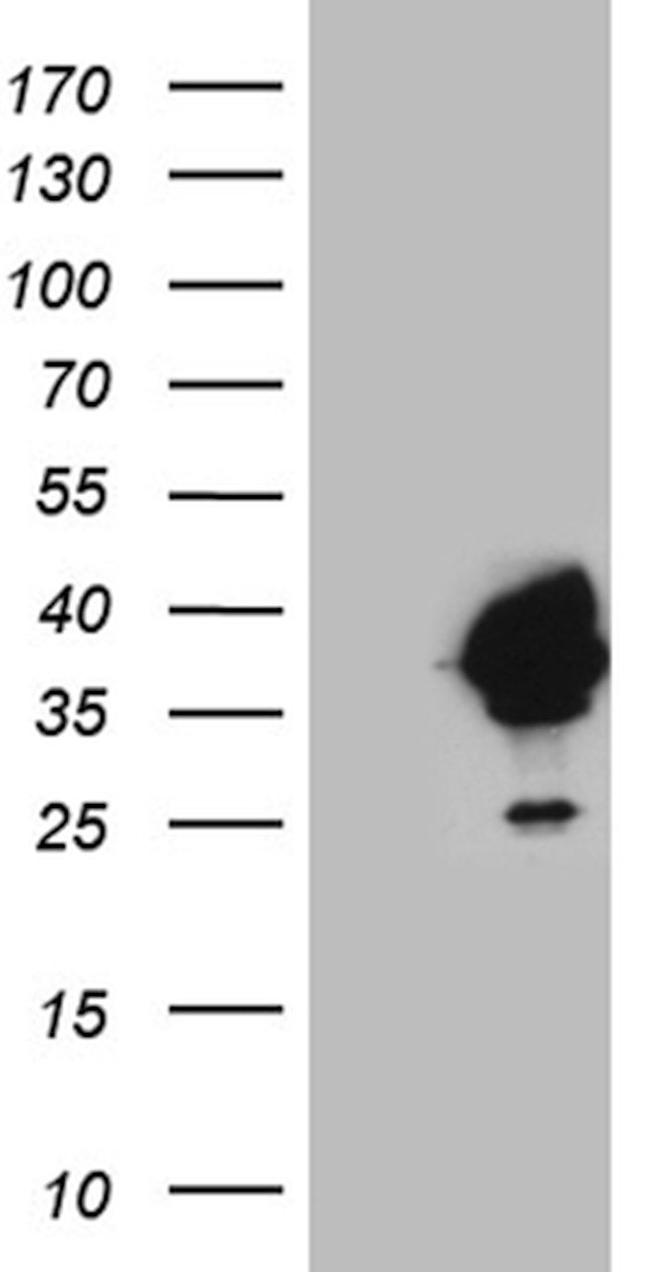 DAPP1 Antibody in Western Blot (WB)