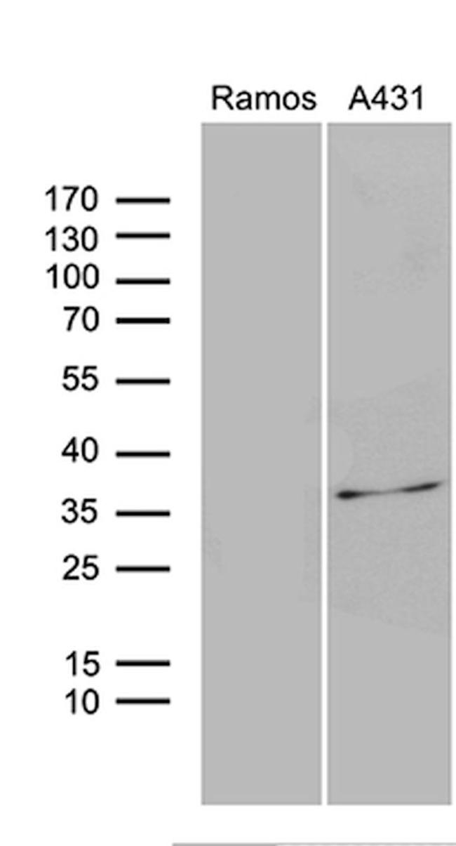 DAPP1 Antibody in Western Blot (WB)