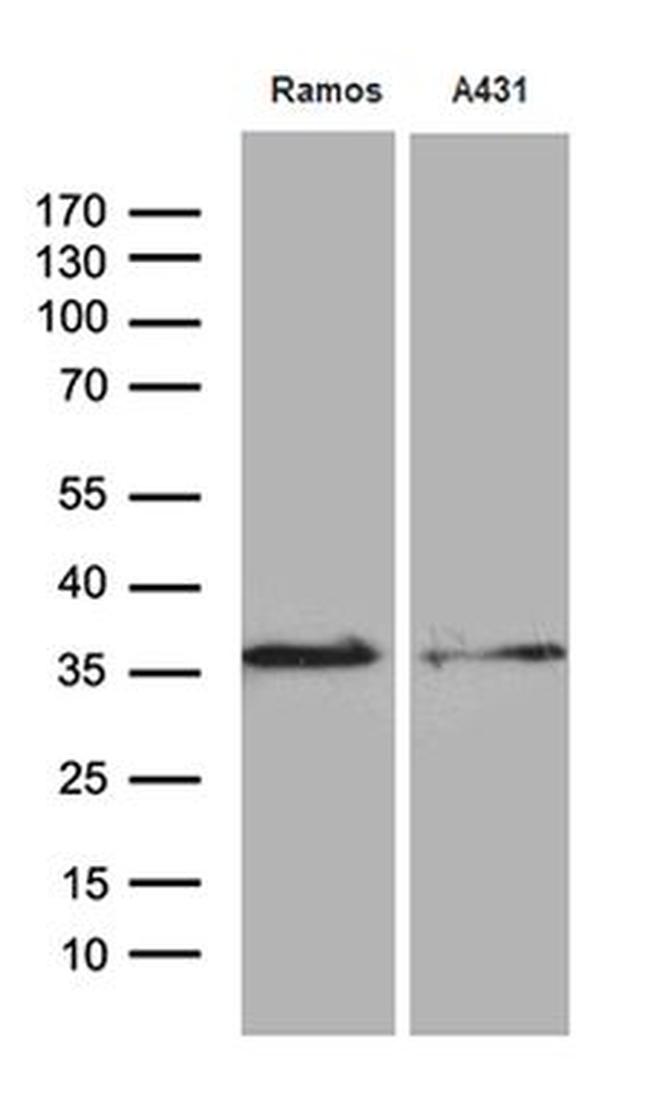 DAPP1 Antibody in Western Blot (WB)