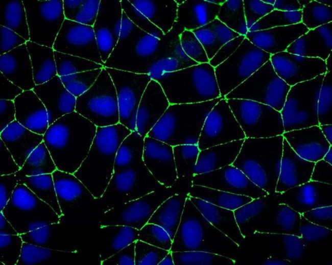 Rabbit IgG (H+L) Highly Cross-Adsorbed Secondary Antibody in Immunocytochemistry (ICC/IF)