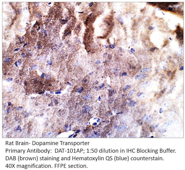 Dopamine Transporter Antibody in Immunohistochemistry (IHC)