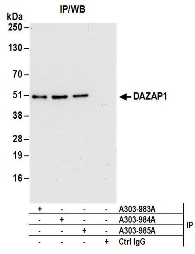 DAZAP1 Antibody in Western Blot (WB)