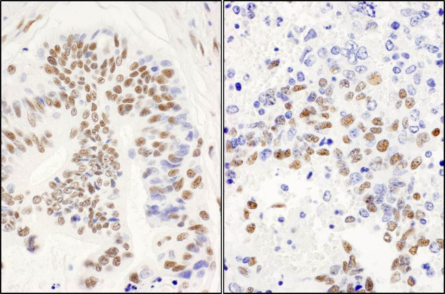 DBC1/p30 DBC Antibody in Immunohistochemistry (IHC)