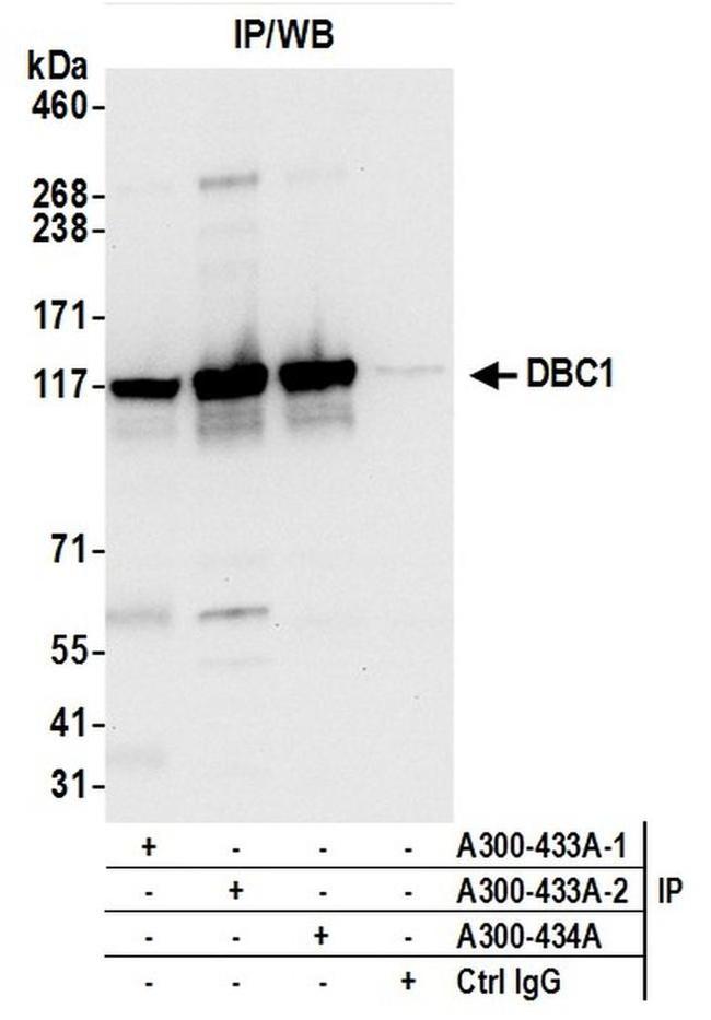 DBC1/p30 DBC Antibody in Western Blot (WB)