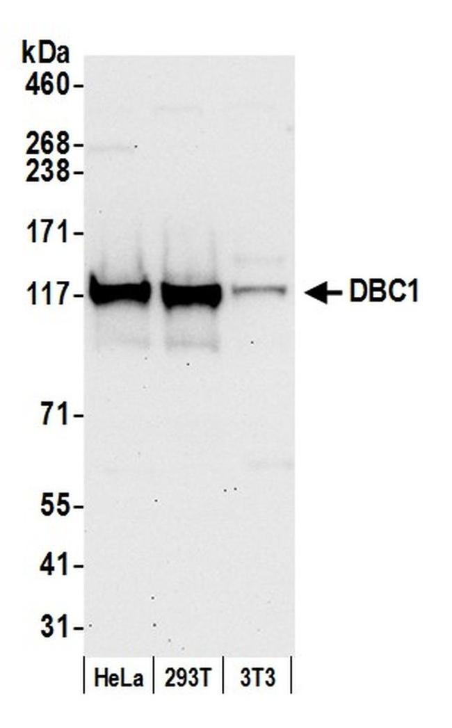 DBC1/p30 DBC Antibody in Western Blot (WB)