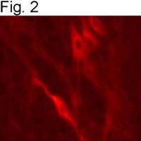 Dopamine beta Hydroxylase Antibody in Immunocytochemistry (ICC/IF)