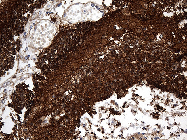 DBN1 Antibody in Immunohistochemistry (Paraffin) (IHC (P))