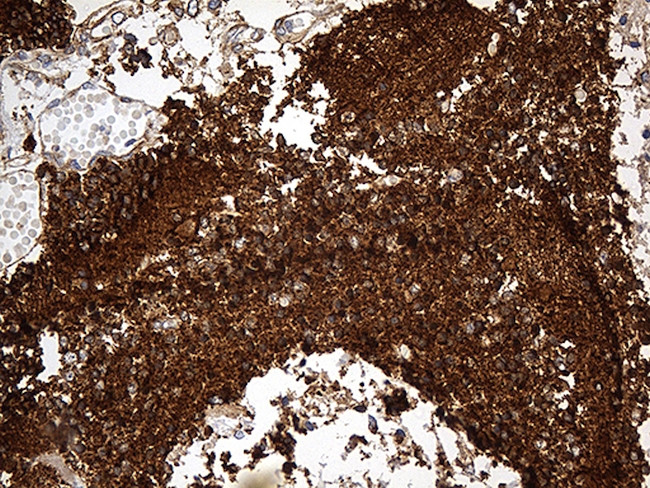 DBN1 Antibody in Immunohistochemistry (Paraffin) (IHC (P))