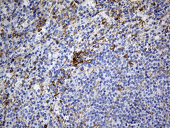 DBN1 Antibody in Immunohistochemistry (Paraffin) (IHC (P))