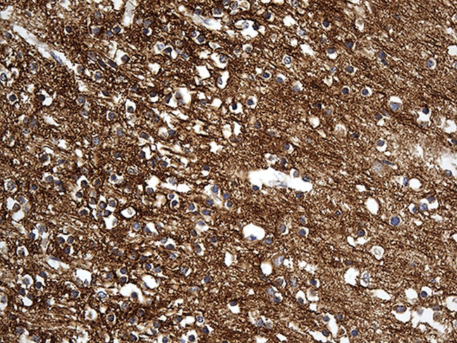 DBN1 Antibody in Immunohistochemistry (Paraffin) (IHC (P))