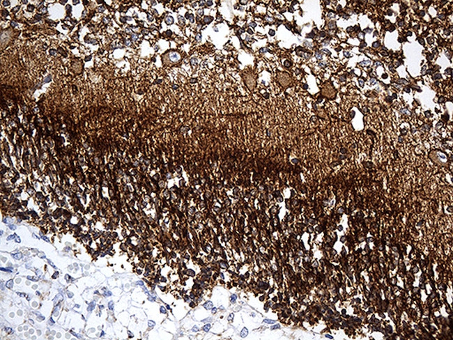 DBN1 Antibody in Immunohistochemistry (Paraffin) (IHC (P))