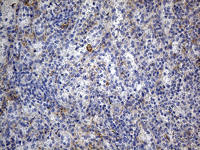 DBN1 Antibody in Immunohistochemistry (Paraffin) (IHC (P))