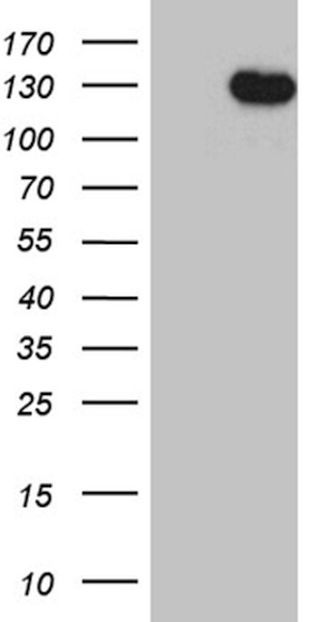 DBN1 Antibody in Western Blot (WB)